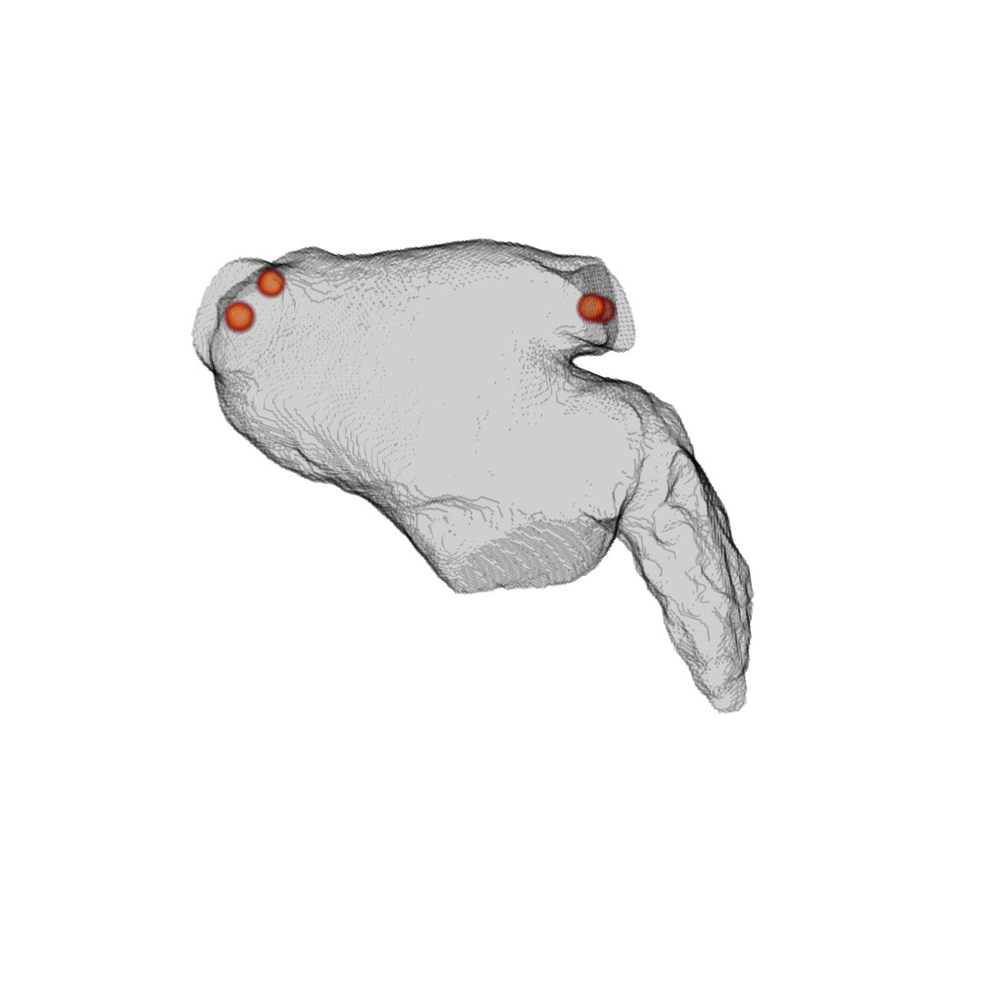 Left atrial blood-flow simulation